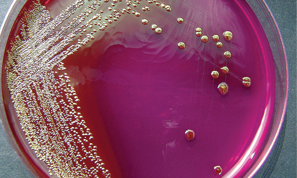 Purple microbiologicals sitting in a Petri dish